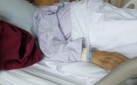 老太切除多器官3个月后去世