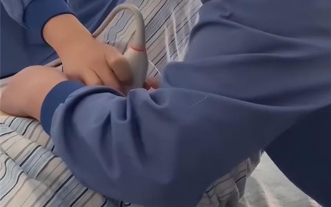 医生隔着妈妈肚皮将宝宝调了个头