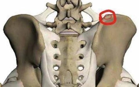 髂骨在哪个位置？示意图详解